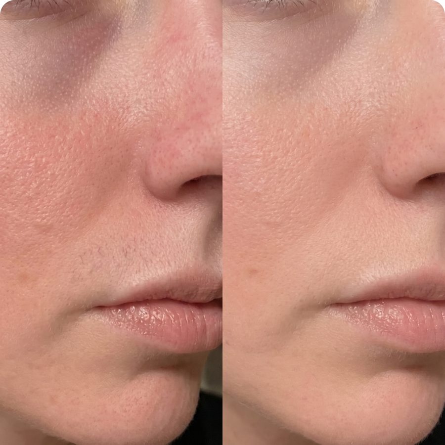 Hair Free Skin